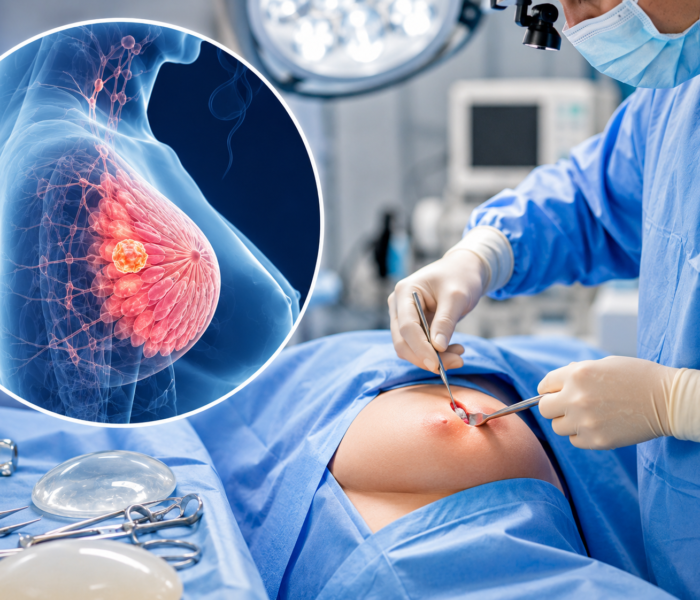 Breast Surgery